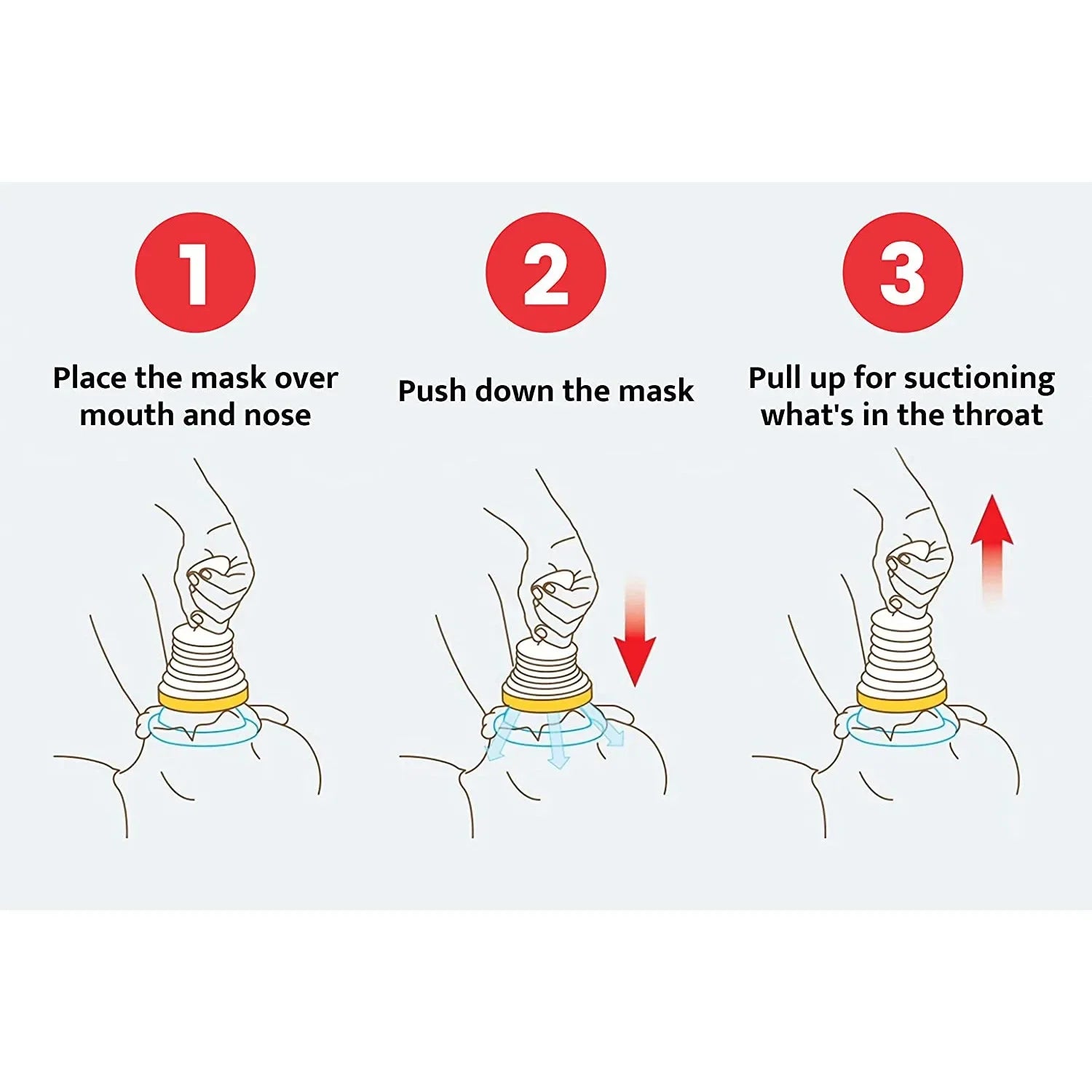 Choking emergency device for quick airway relief.